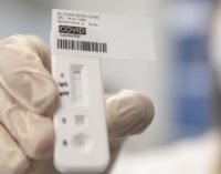 Тестирование ПЦР в столице делают только лицам с симптомами COVID-19 — Кличко