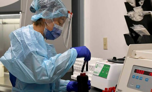 Минздрав собирается проверить украинцев на наличие антител к COVID-19