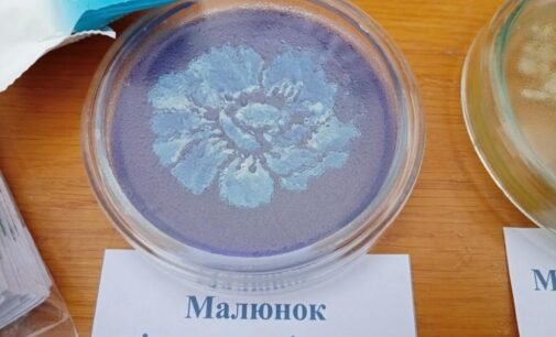 У ботанічному саду ДНУ пройде виставка малюнків, які зробили мікроби